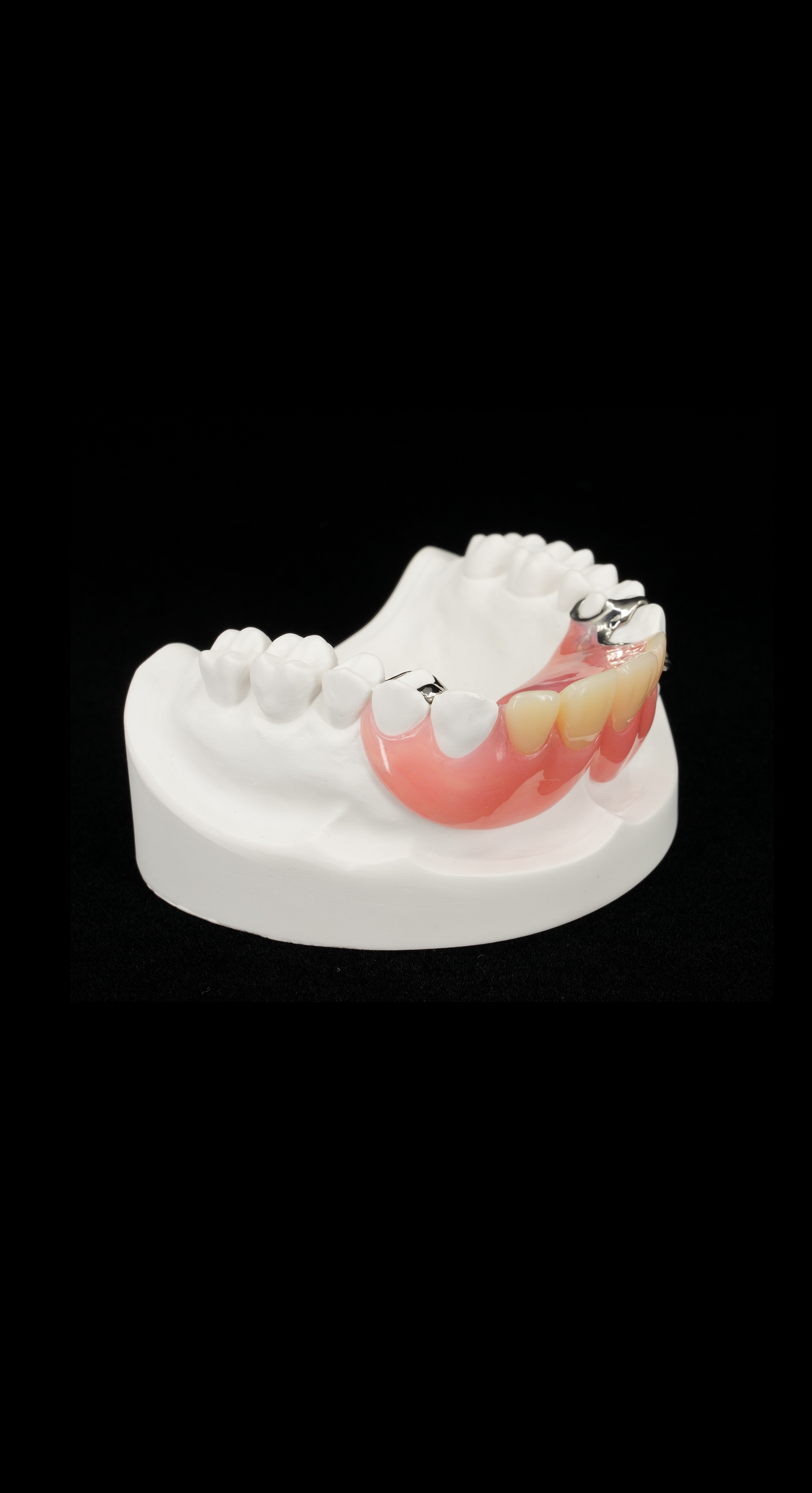 ノンスクラプ入れ歯の画像