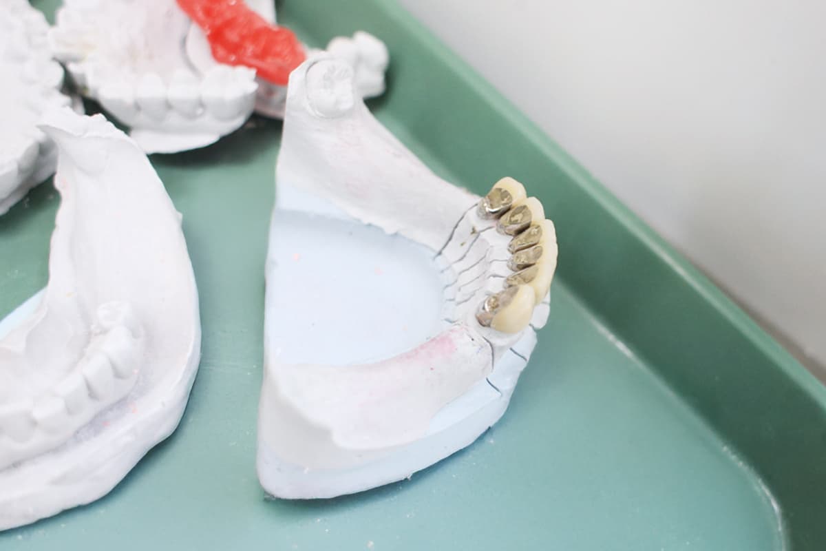入れ歯製作風景の画像